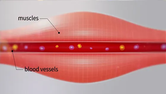 Normal muscles