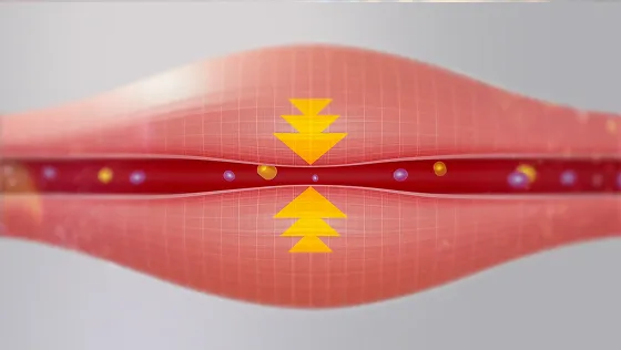 Muscle tension compresses the blood vessels